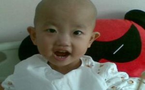 白血病是怎么引起的 原因是什么