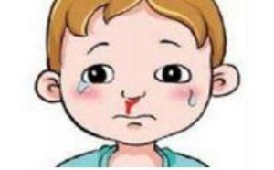 鼻子出血怎么办 应对措施有哪些