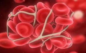 熊猫血是什么血型知乎