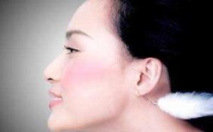 脸上起了密密麻麻的小疙瘩怎么办