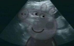 张歆艺晒B超照宣布怀孕 盖上小猪佩奇图暗示金猪宝宝 