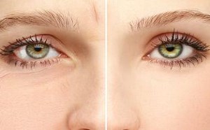 牙膏怎么去眼袋 牙膏去眼袋的方法步骤