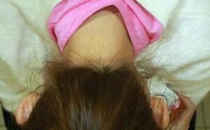 大肠癌的早期症状有4表现一定要警惕