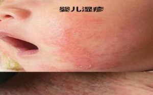 四维检查单子怎么看胎儿性别