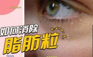 脸上长脂肪粒怎么办怎么才能消除