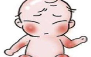 皮肤过敏症怎么快速止痒 方法有哪些