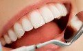 牙结石怎么去除 去除牙结石的偏方